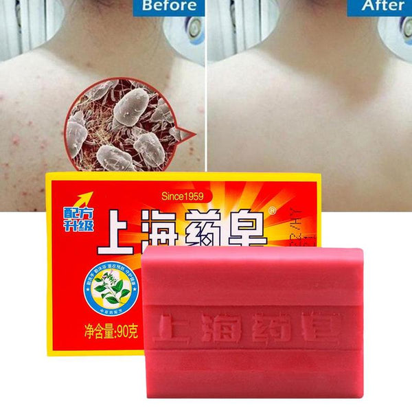 90g Red China Medicated Soap Conditions Acne Psoriasis Seborrhea Eczema Anti Fungus Bath Healthy Soap Slimming Body Cream