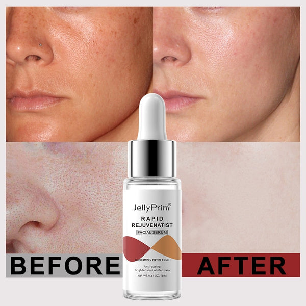 Dark Spots Whitening Skin Care Serum Niacinamide For Glowing Skin Hyaluronic Acid Collagen Pore Reduction Face Serum Care Beauty