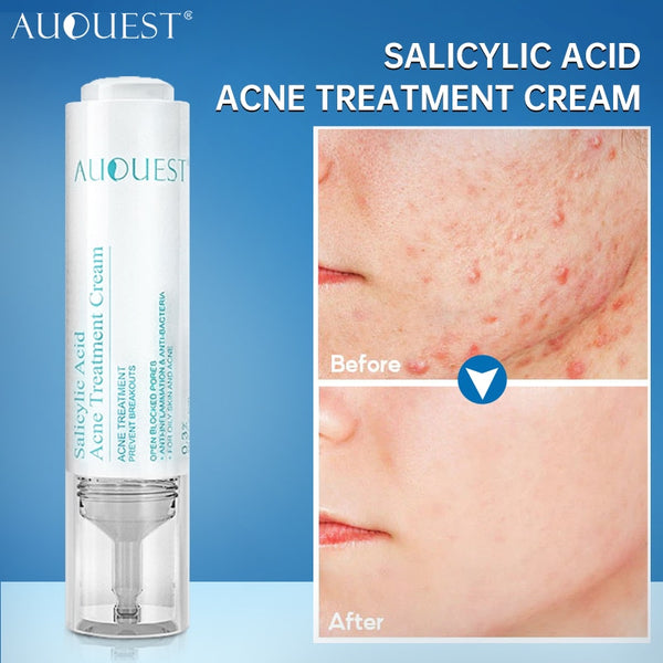 AUQUEST Salicylic Acid Acne Face Cream Skin Care Hyaluronic Acid Black Dots Acne Pimple Remove Treatment Cream Beauty Health